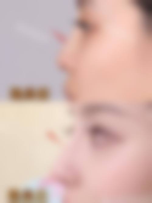 台州美嘉美医疗美容门诊部擅长项目。