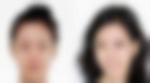 台州美嘉美医疗美容门诊部治疗反馈与口碑评价。