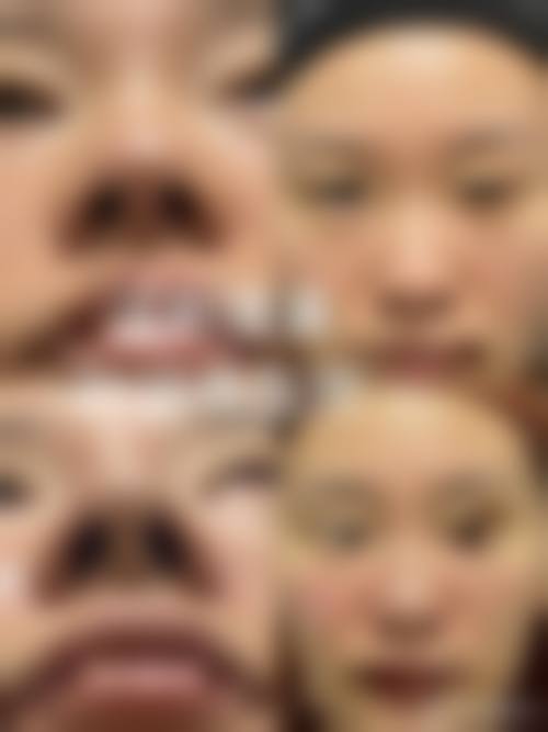 银川妮好漂亮医疗美容门诊部治疗反馈与口碑评价。