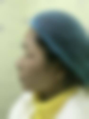 北京珍意整形医院医生团队经验稳定。