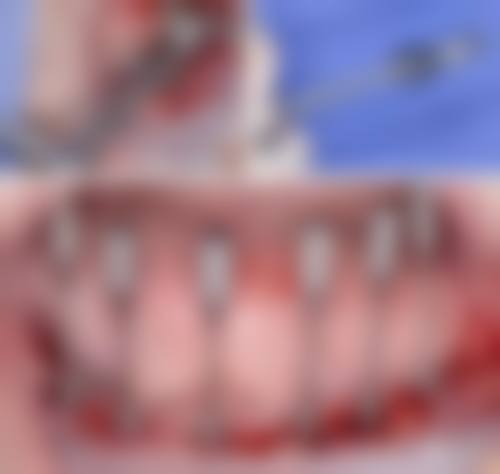 优惠活动详情