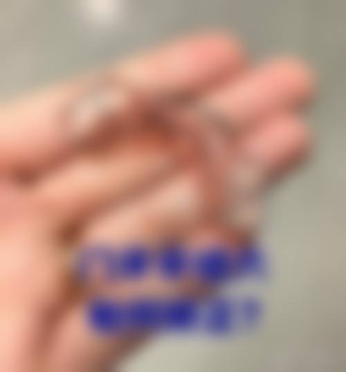 杨志恒医生技术与实力展现