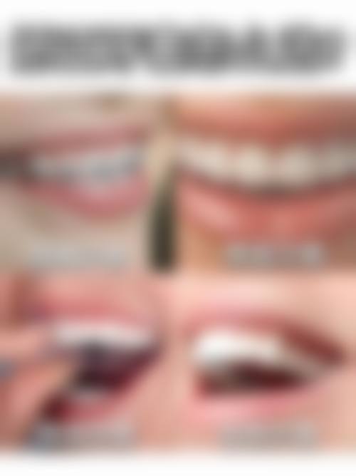 临床实例分享:杜勇医生的真实实例成效如何?