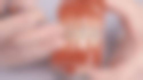 临床实例分享