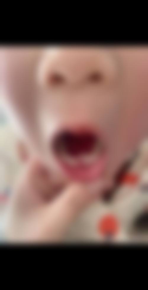 刘章礼医生的擅长项目
