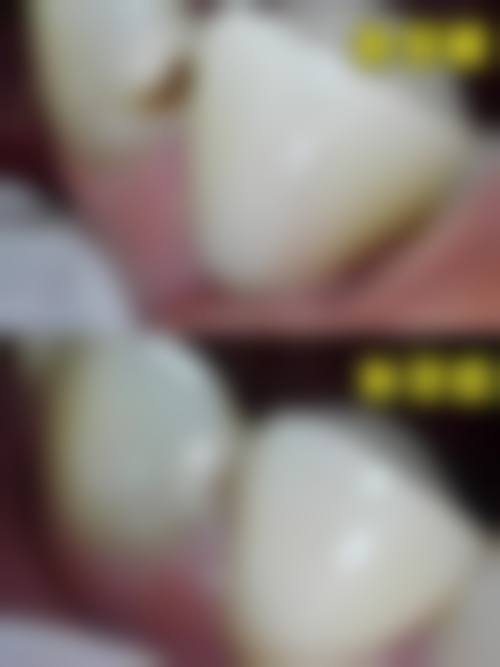 山东济南一牙口腔的口碑好不好?听听患者的真实评价