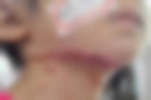 昆山第一人民医院烧伤整形科怎么样——口碑评价