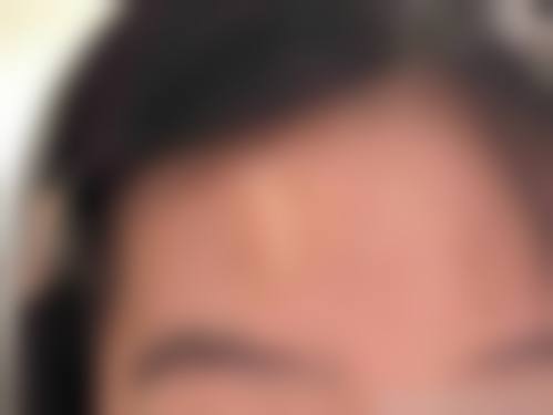 许澍洽医生项目优势