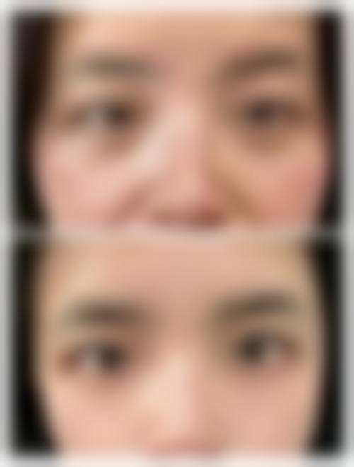 中山科曼整形医院项目优势在哪?