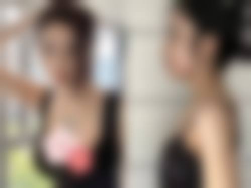 台州美嘉美医疗美容门诊部医生团队经验稳定。