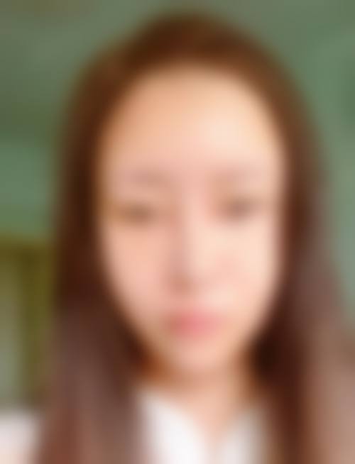 南阳医韩国内外微整形诊所擅长项目。