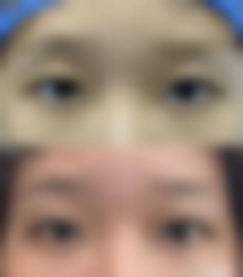 中山科曼整形医院擅长项目。