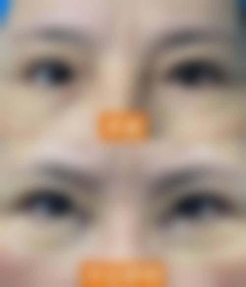 万州爱瑞阳光眼科医院2026年价格收费表: