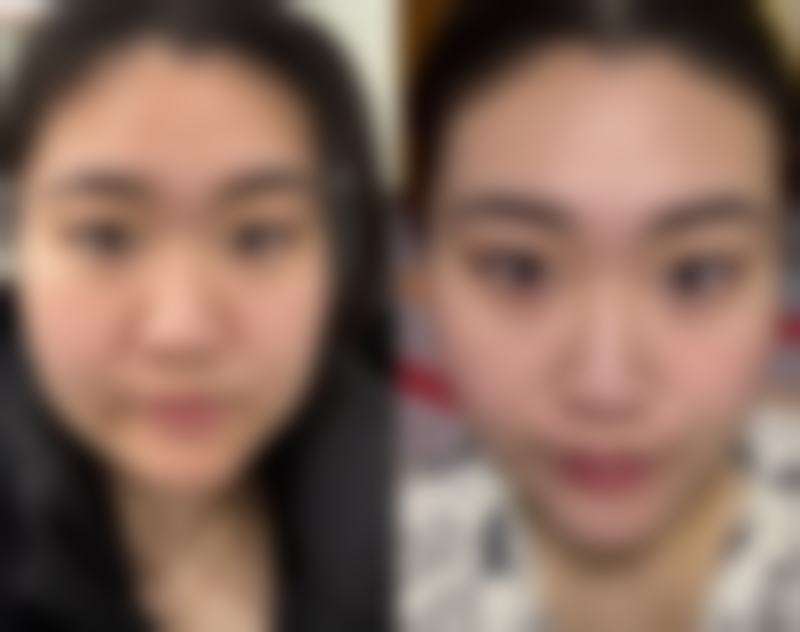 新乡东方美整形医院项目特色