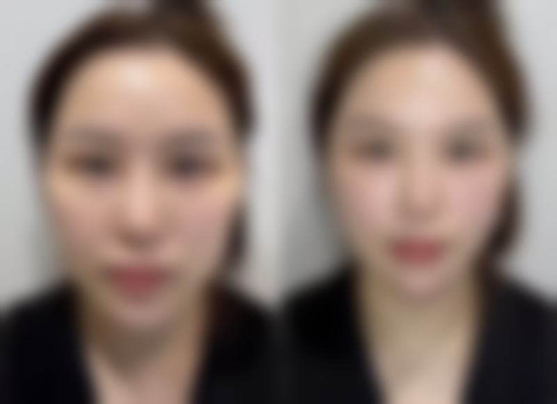 深圳妍熙妍医疗美容门诊部口碑评价