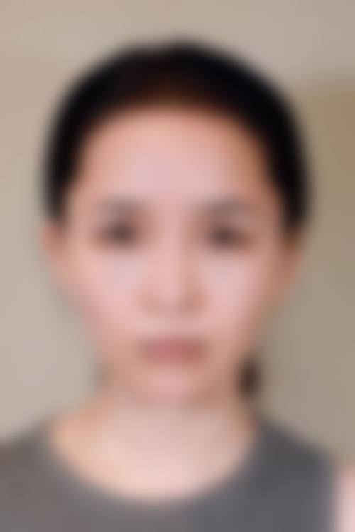 Henri Clinic 名古屋院的收费价格参考(2026年)
