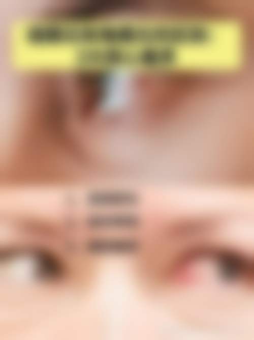柘城普明眼科医院的收费价格参考(2026年)