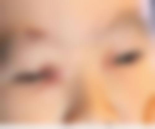 临床实例分享