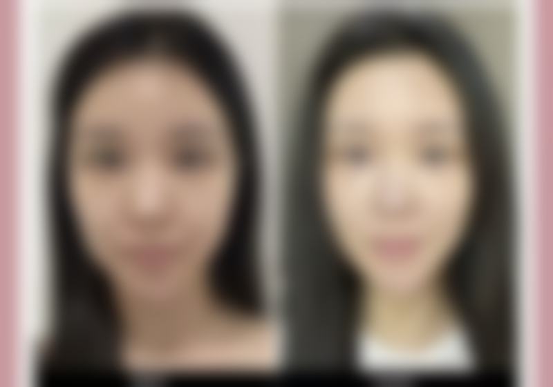胡吉贵医生具体擅长哪些皮肤美容项目?
